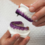 Behandlung mit Zahnschienen